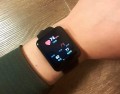 Xiaomi Redmi Watch 2 Lite