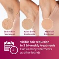 Philips Philips Lumea Advanced BRI 923