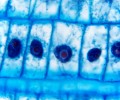 DELTA optical Genetic Bino