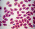 DELTA optical Genetic Bino