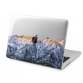 Lex Altern Case Hard Cover for MacBook Pro Retina 13