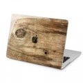 Lex Altern Case Hard Cover for MacBook Pro Retina 13