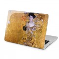 Lex Altern Case Hard Cover for MacBook Pro Retina 13