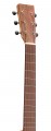 Martin 000-15E