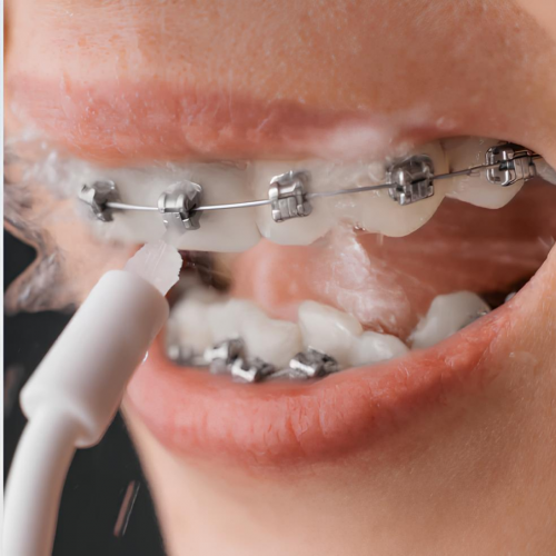 Bitvae BIT IRR 4 pcs