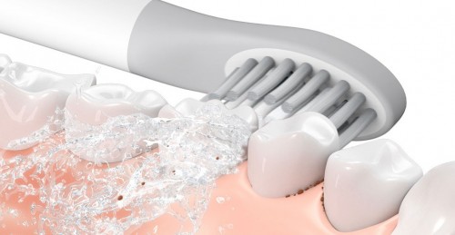 Xiaomi So White Sonic Electric Toothbrush